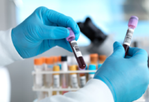 MonkeyPox: LGBTQ Community Maybe at Greater Risk of MonkeyPox Infection – CDC.