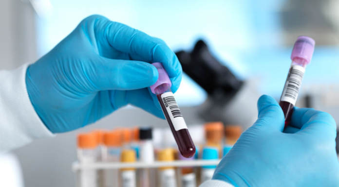 Is it correct to say 5G Network causes Coronavirus?