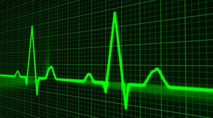 Stroke Signs Will Warn Days Before the Actual Attack – Study.